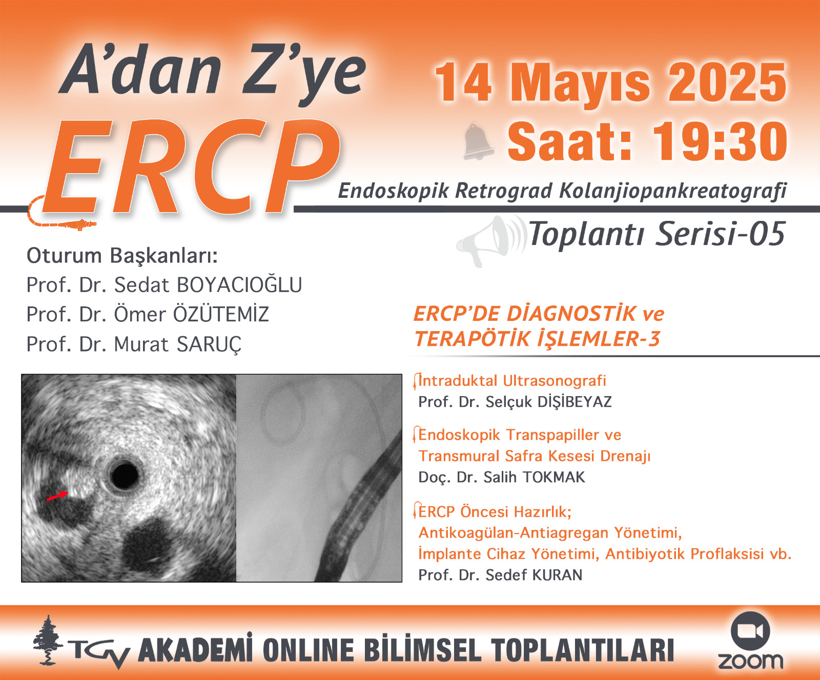 A'dan Z'ye ERCP